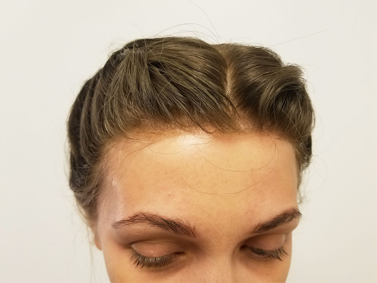 Seamless wigs with scalp matching complexsion for a seamless look indistinguishable from your natural hair.